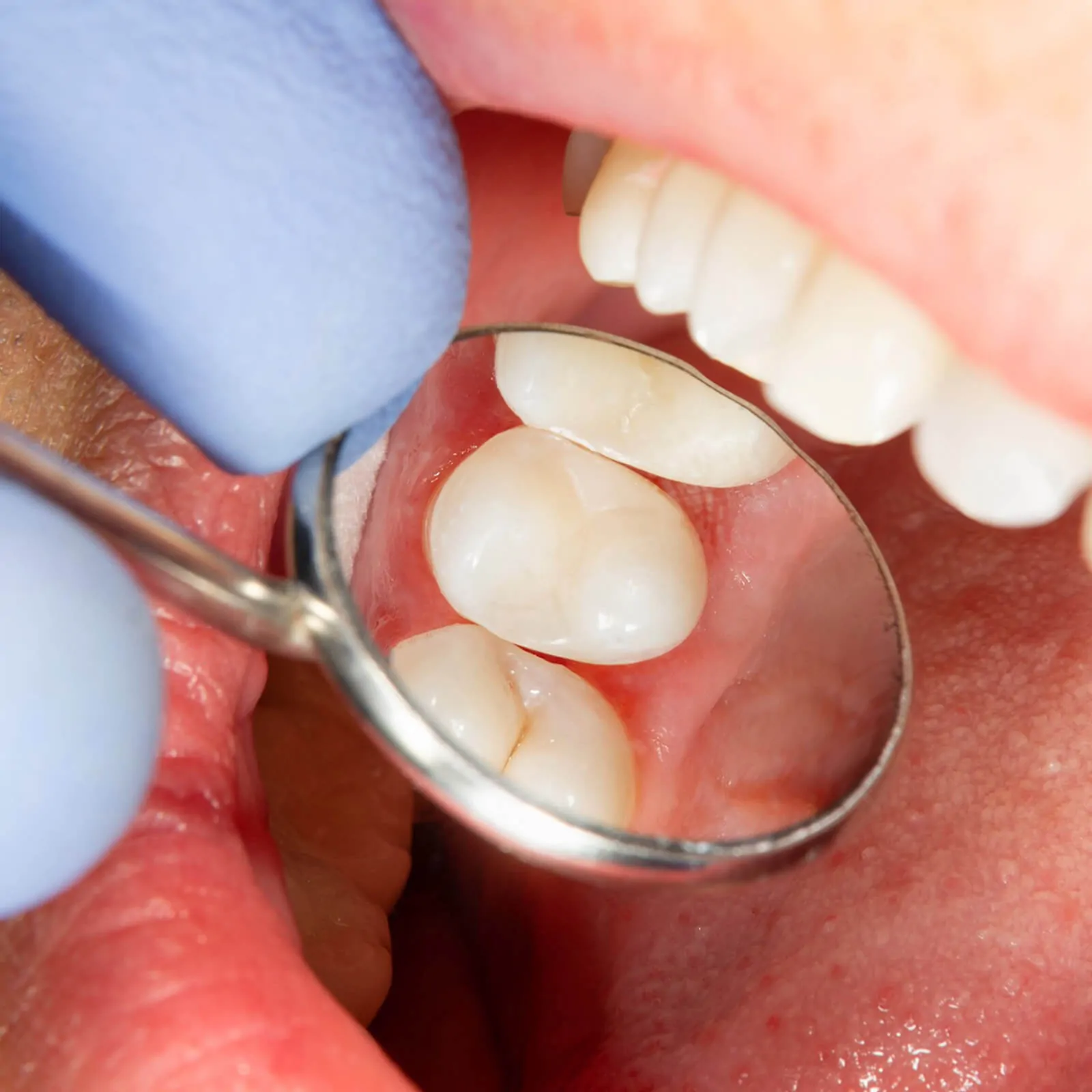 pd-testimonial-bryan