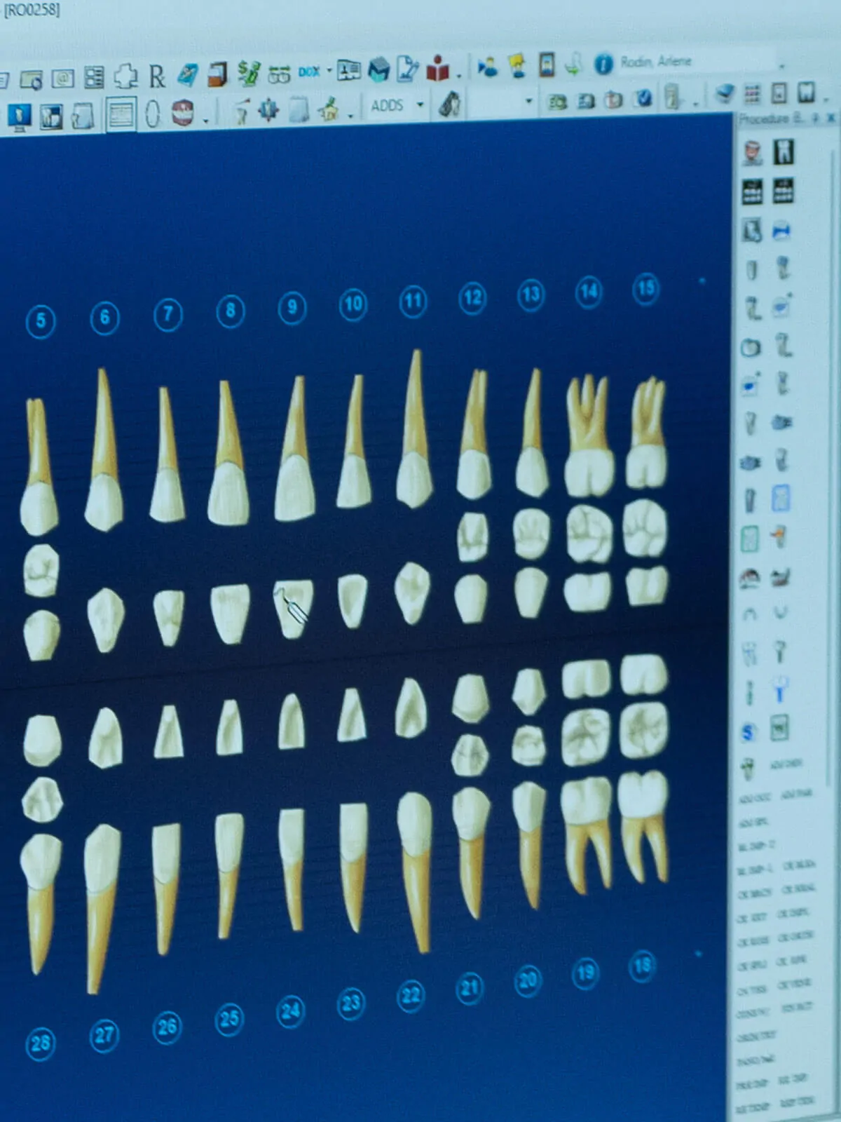 pd-gallery-digital-chart